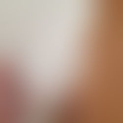 J'ai testé le peeling pour pied de Lova Skin