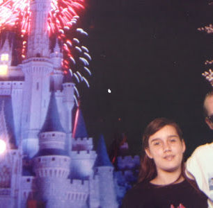 Before and after wearing the Milwaukee brace