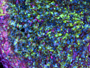 Investigating novel cancer multidrug resistance inhibitors