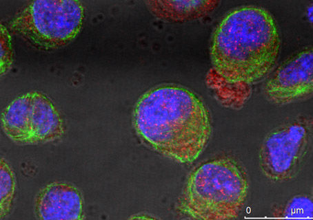 Designing novel therapeutic strategies for hematological malignancies