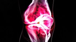 Ski Injuries - Knee Issues