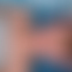 L’efficacité des sessions en ostéopathie sur les céphalées de tension