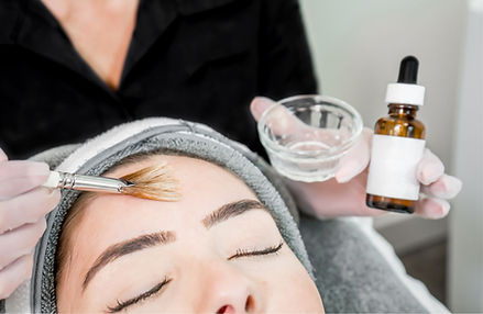 My Bare Skin | Chemical Peel