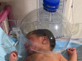 Tabasco: bebé es atendido con botella en hospital del IMSS