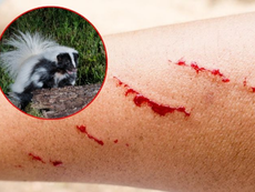 Confirman caso de rabia humana en Zacatecas