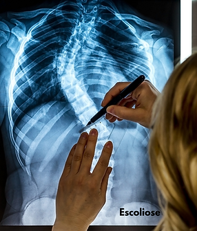 Osteopatia Pediátrica (1).png