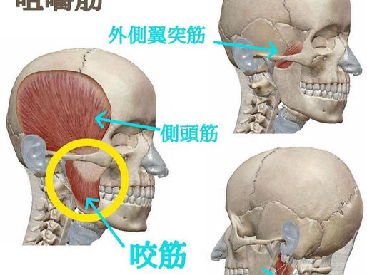エラ張りでお悩みの方いませんか？？