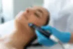 Depilación láser