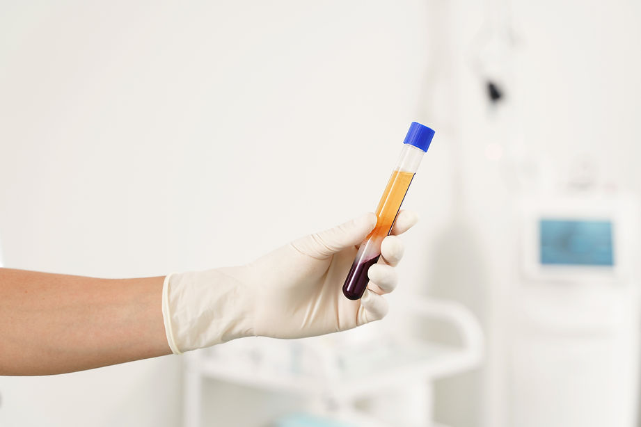 Nurse holding vacutainer with a platelet-rich plasma and blood for PRP treatment.jpg