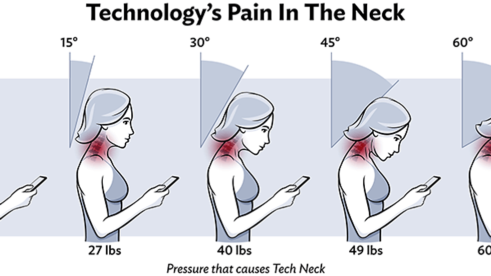 Diagram showing how technology and posture can create neck pain