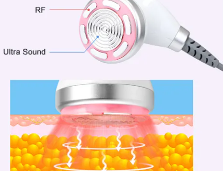 Cavitation & RF
