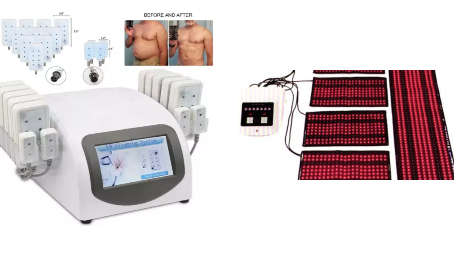 Beginner’s Guide to Laser Lipo Treatments