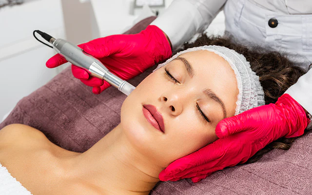 MICRONEEDLING.webp