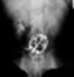 Swallowed Turtle X-Ray