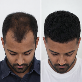 ChatGPT Image Jan 22, 2026, 06_39_25 PM.png