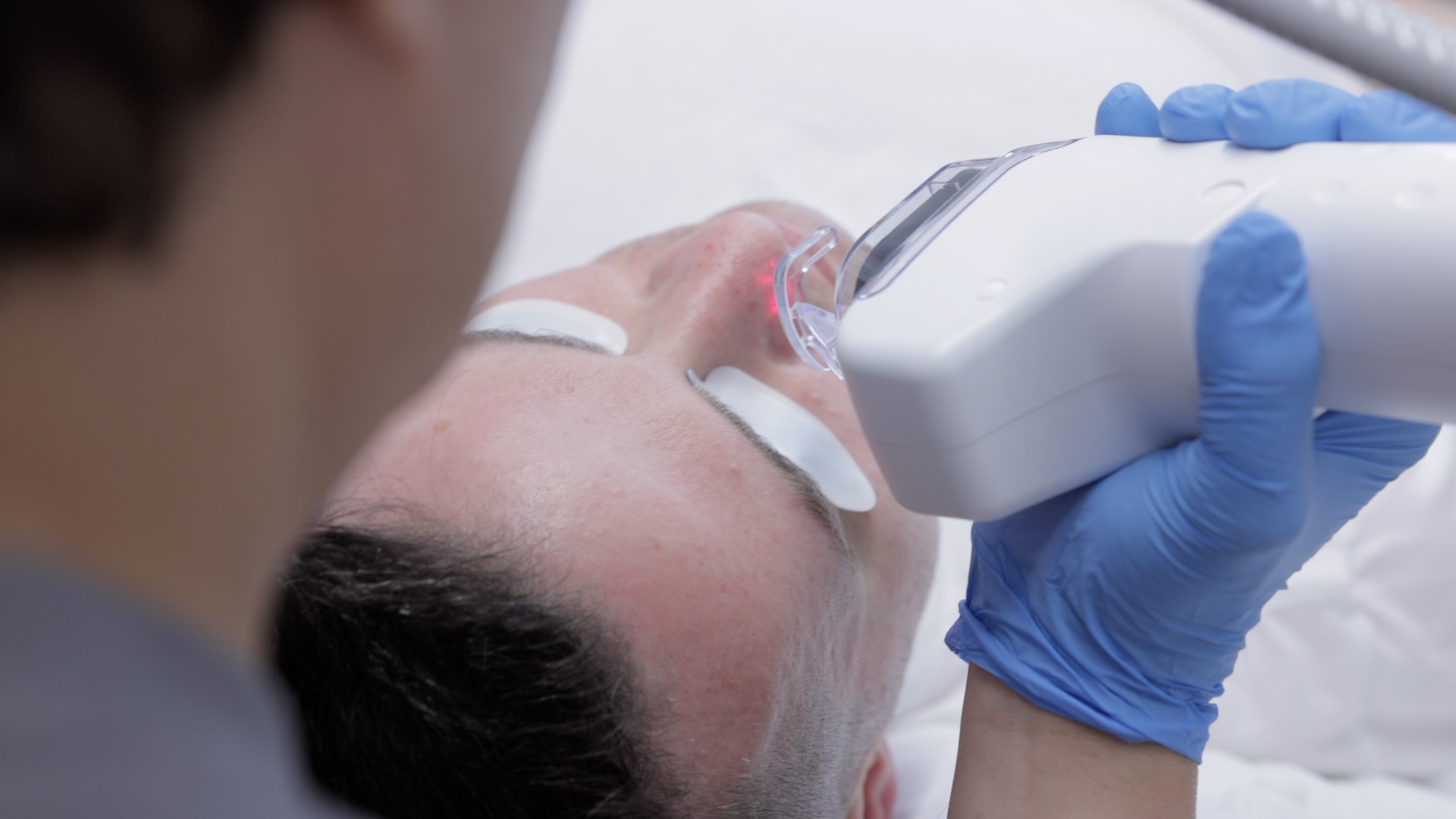 EdgeOne CO₂ Laser — SoHo Men's Health