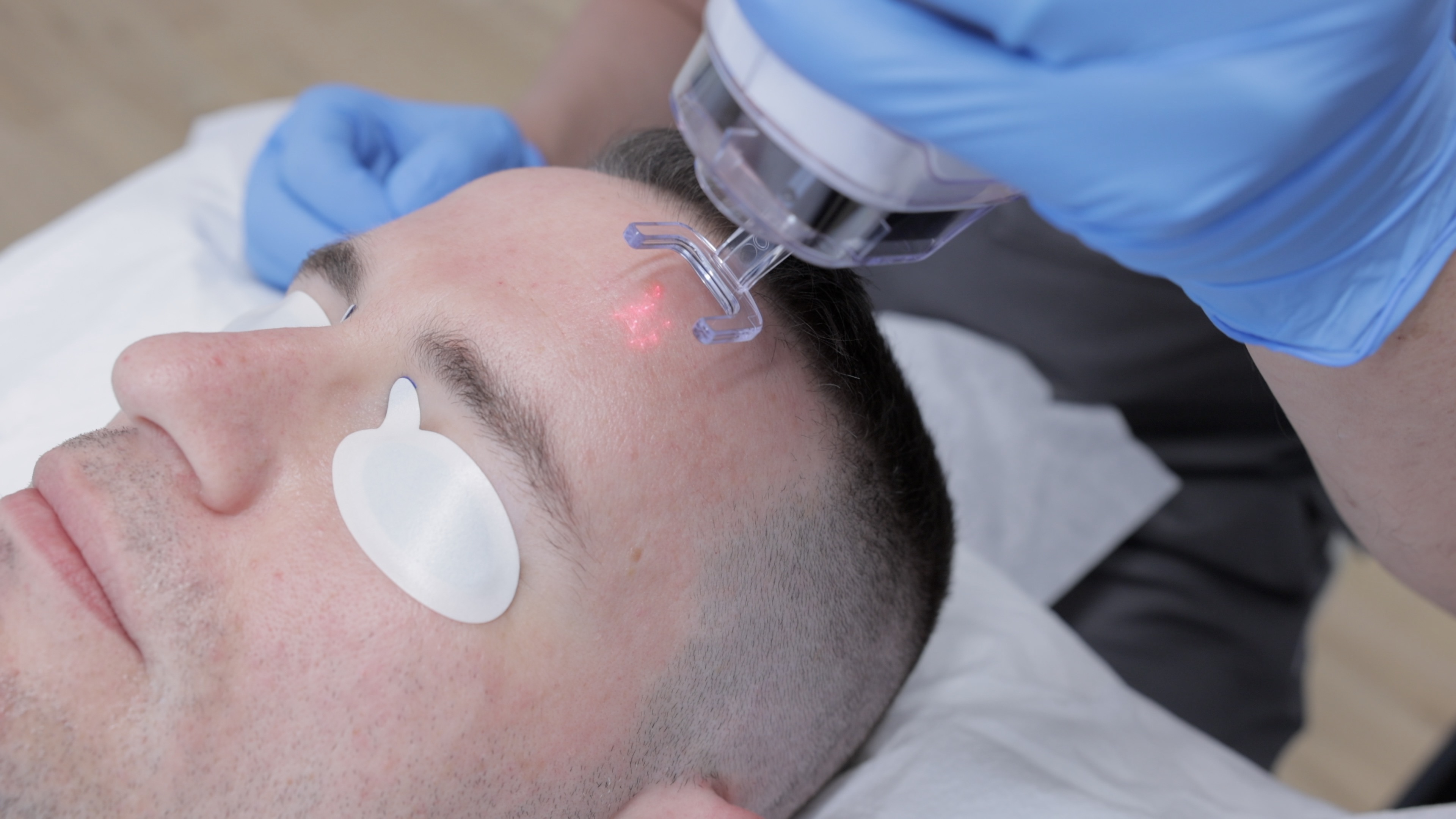 EdgeOne CO₂ Laser — SoHo Men's Health