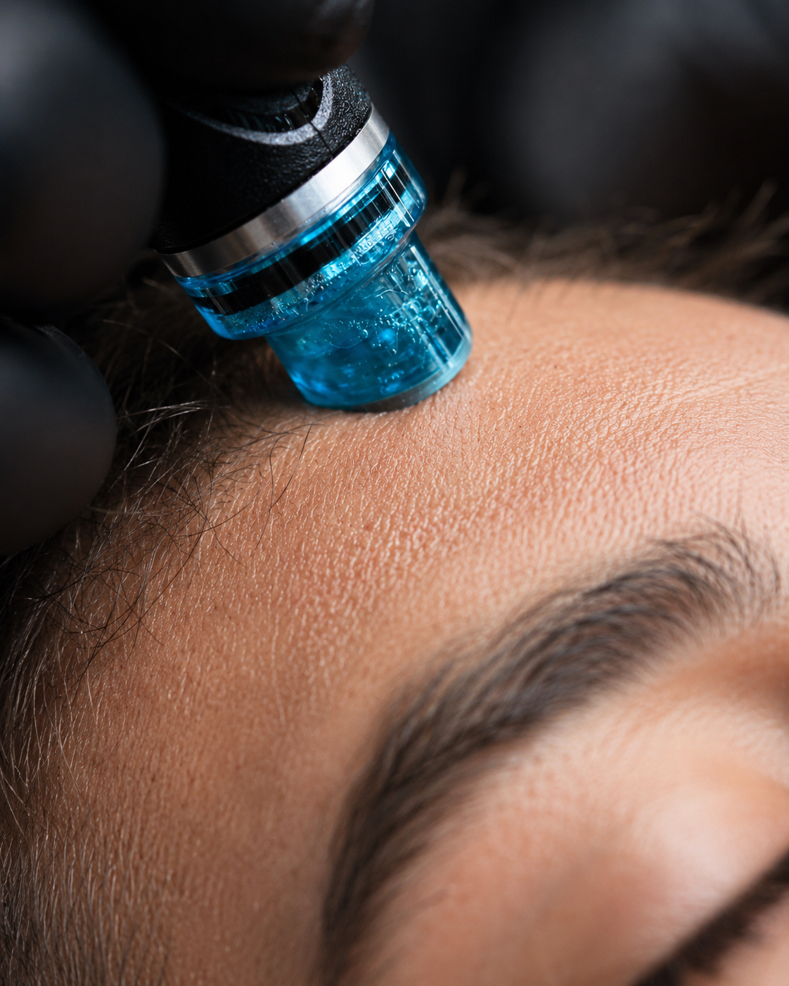 HydraFacial at SoHo Men's Health