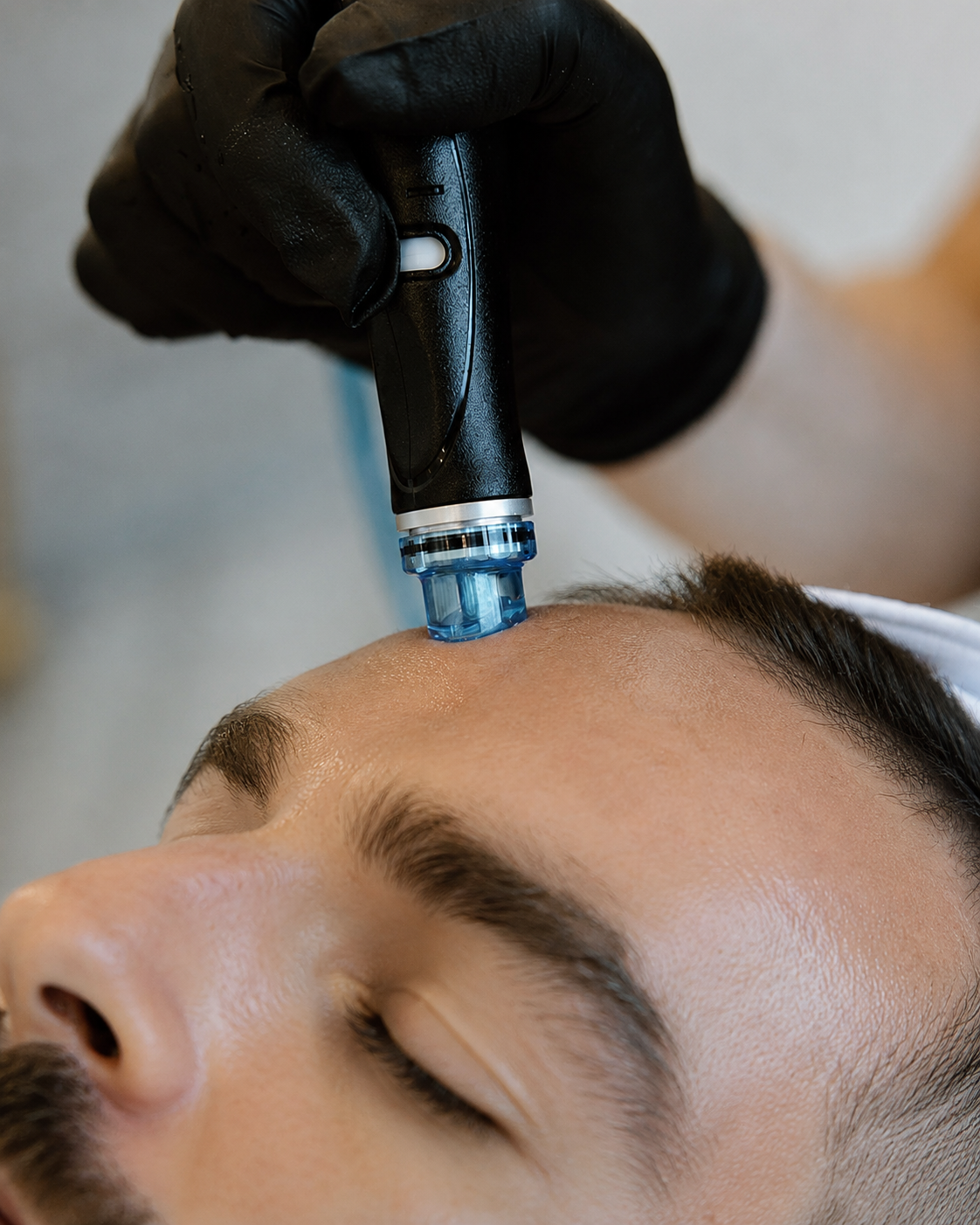 HydraFacial treatment at SoHo Men's Health