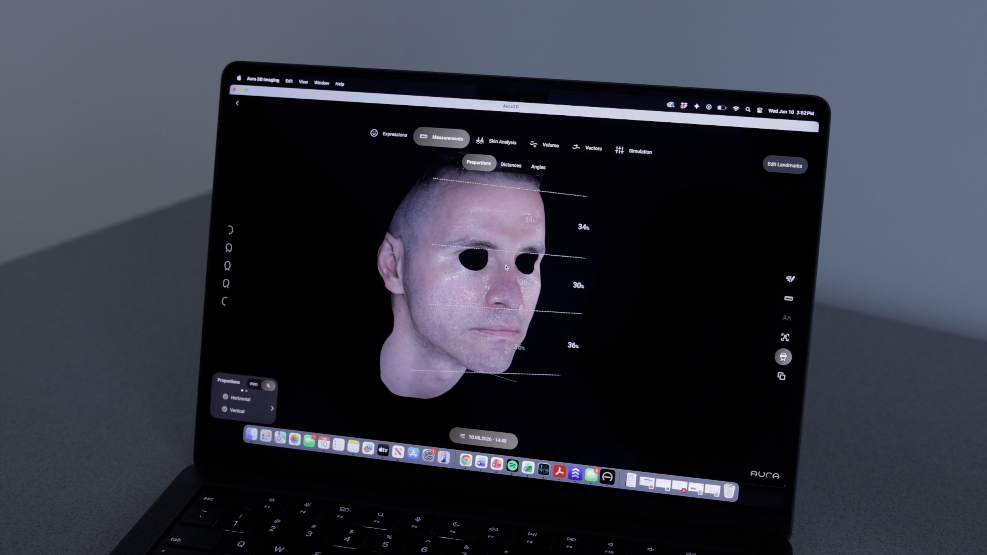 AI-driven 3D face analyzer consultation image 1