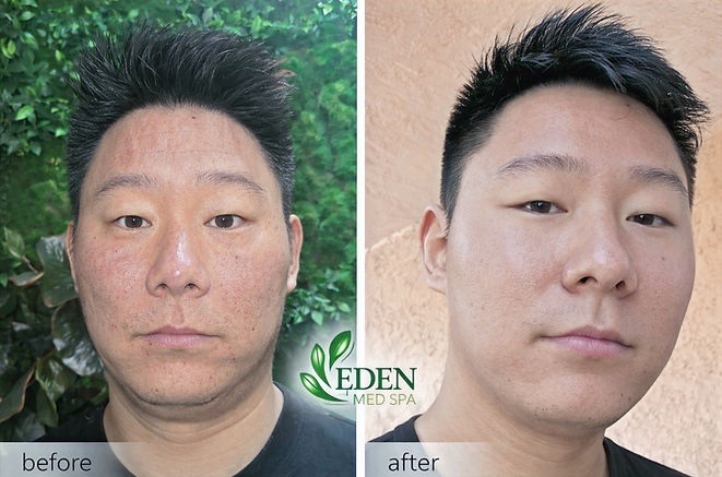 tony before and after ok_edited.jpg