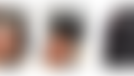 Why Scalp Health Is the Secret to Healthy Hair