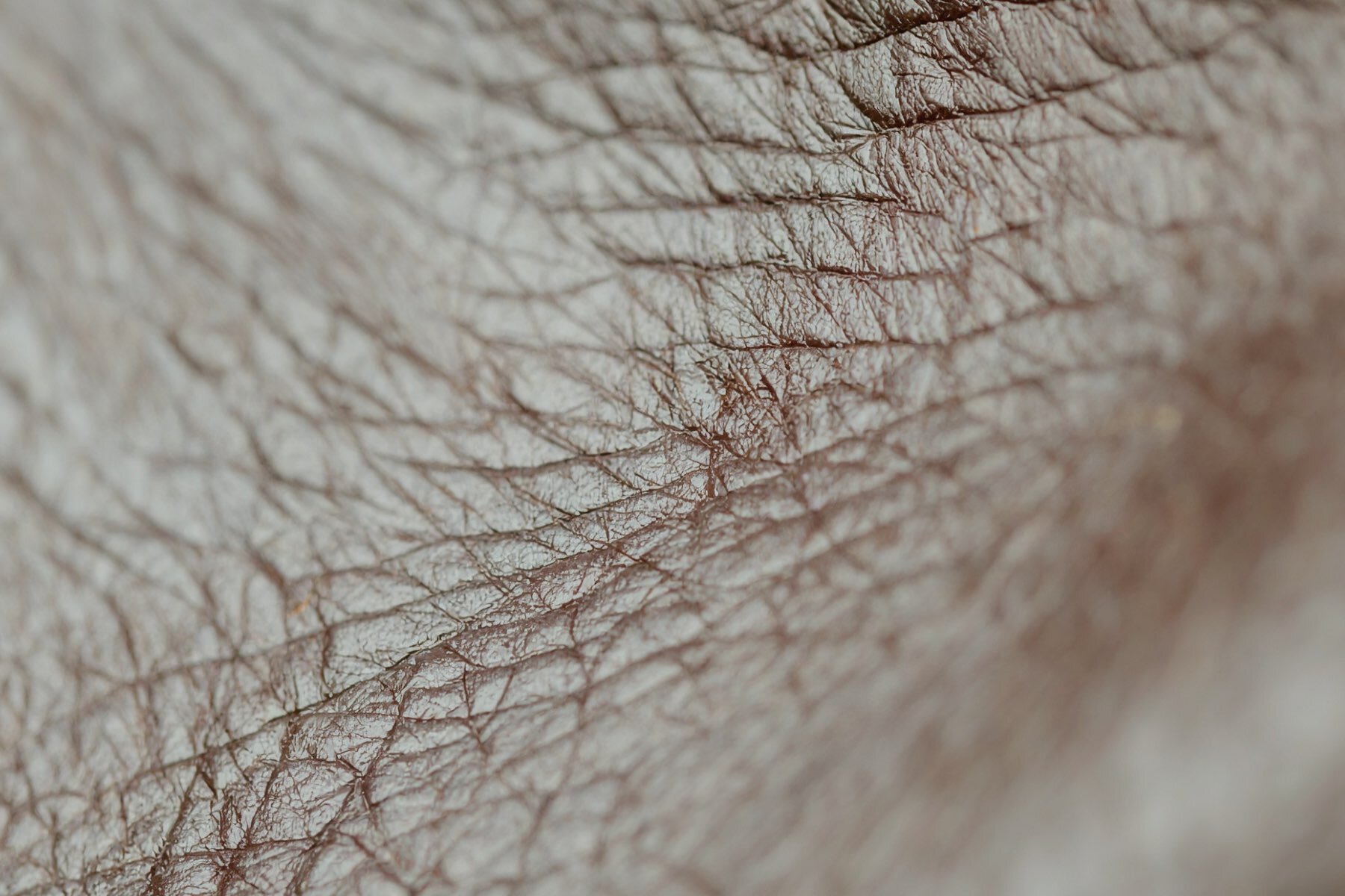 IPL treatment on the face at Reborne, Marylebone, London