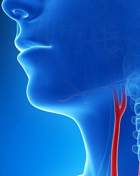 carotid-artery-800w.jpg