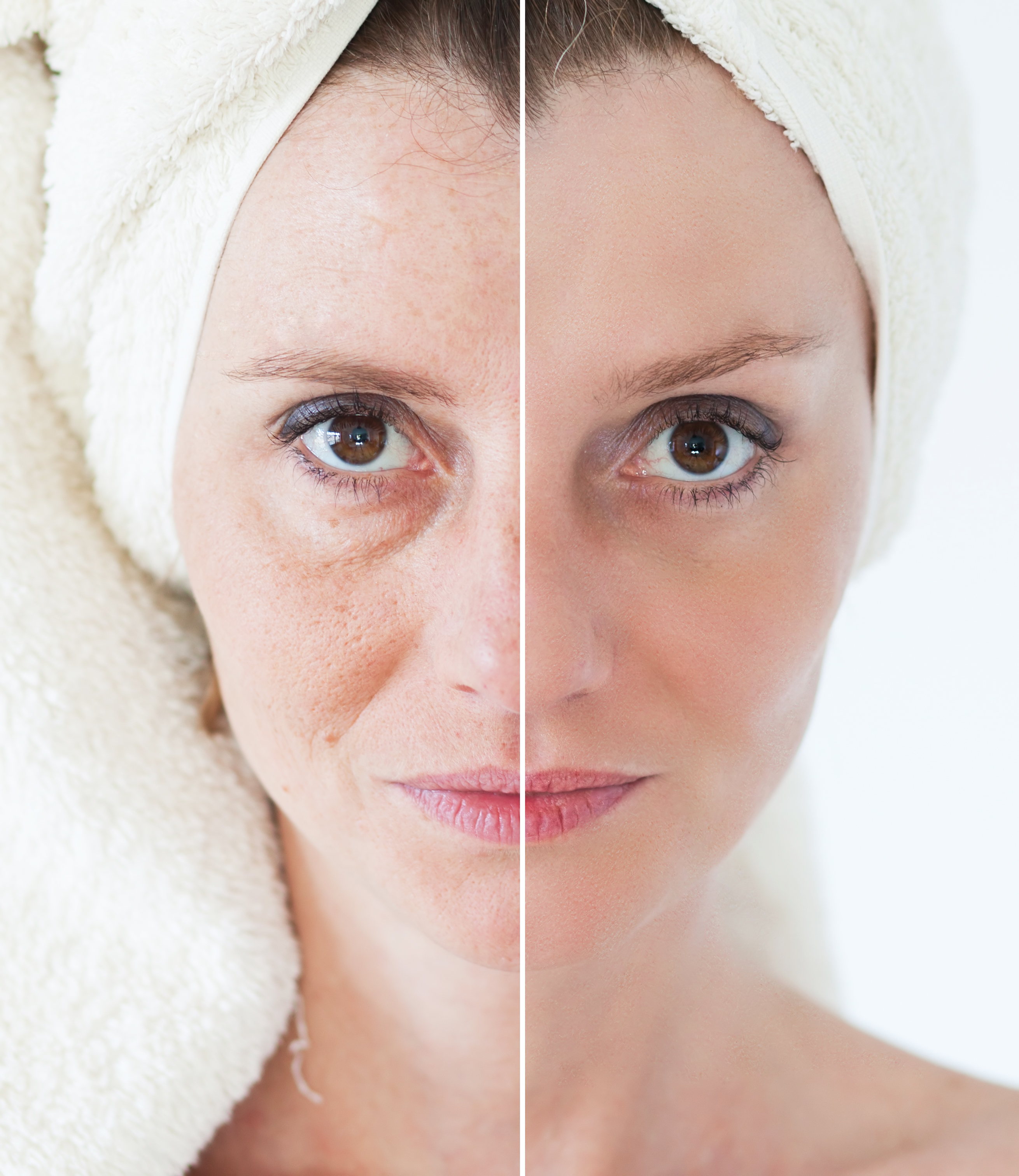 Professional Peel 35 min $95