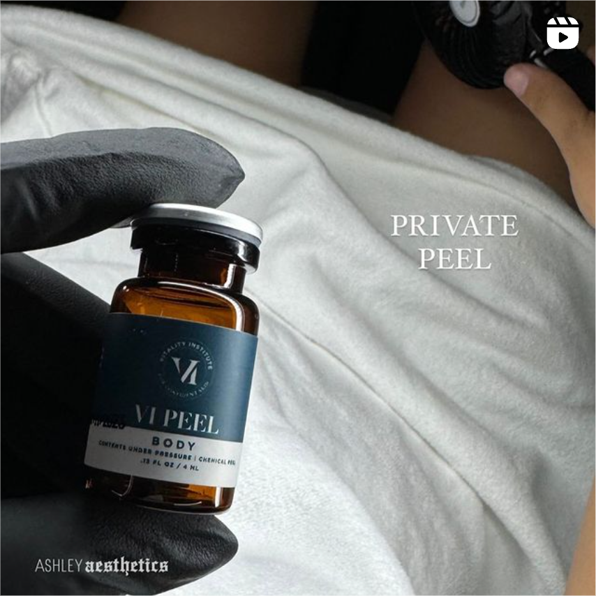 VI Chemical Peel Bay Area