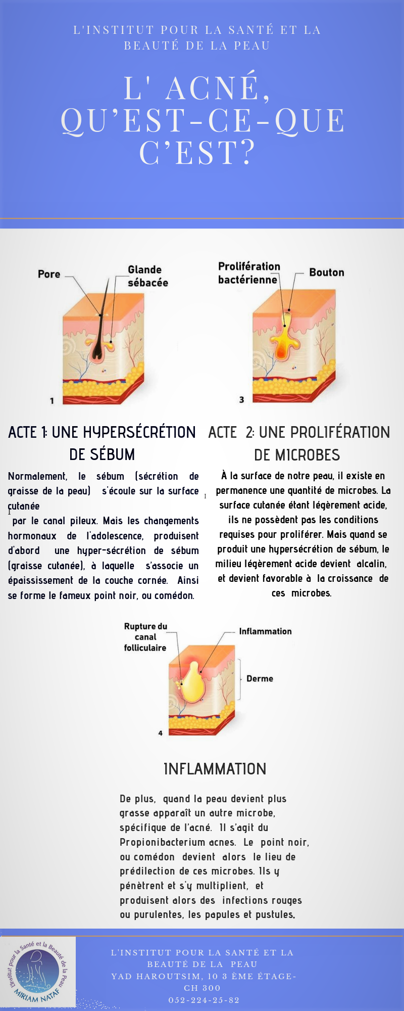 déroulement de l’acné