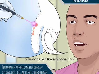 Cara Menyembuhkan Kutil Di Kelamin