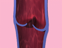 vein.gif