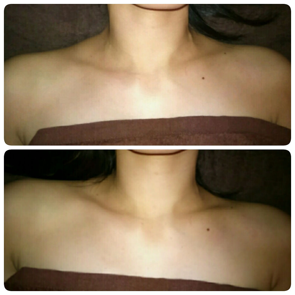 もみほぐし　前面左側の肩周り、首、腕の店術首