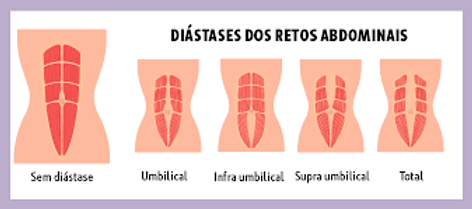 TIPOS DE DIÁSTASE
