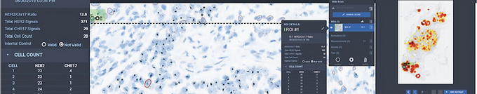 Estudios de hibridación in situ
