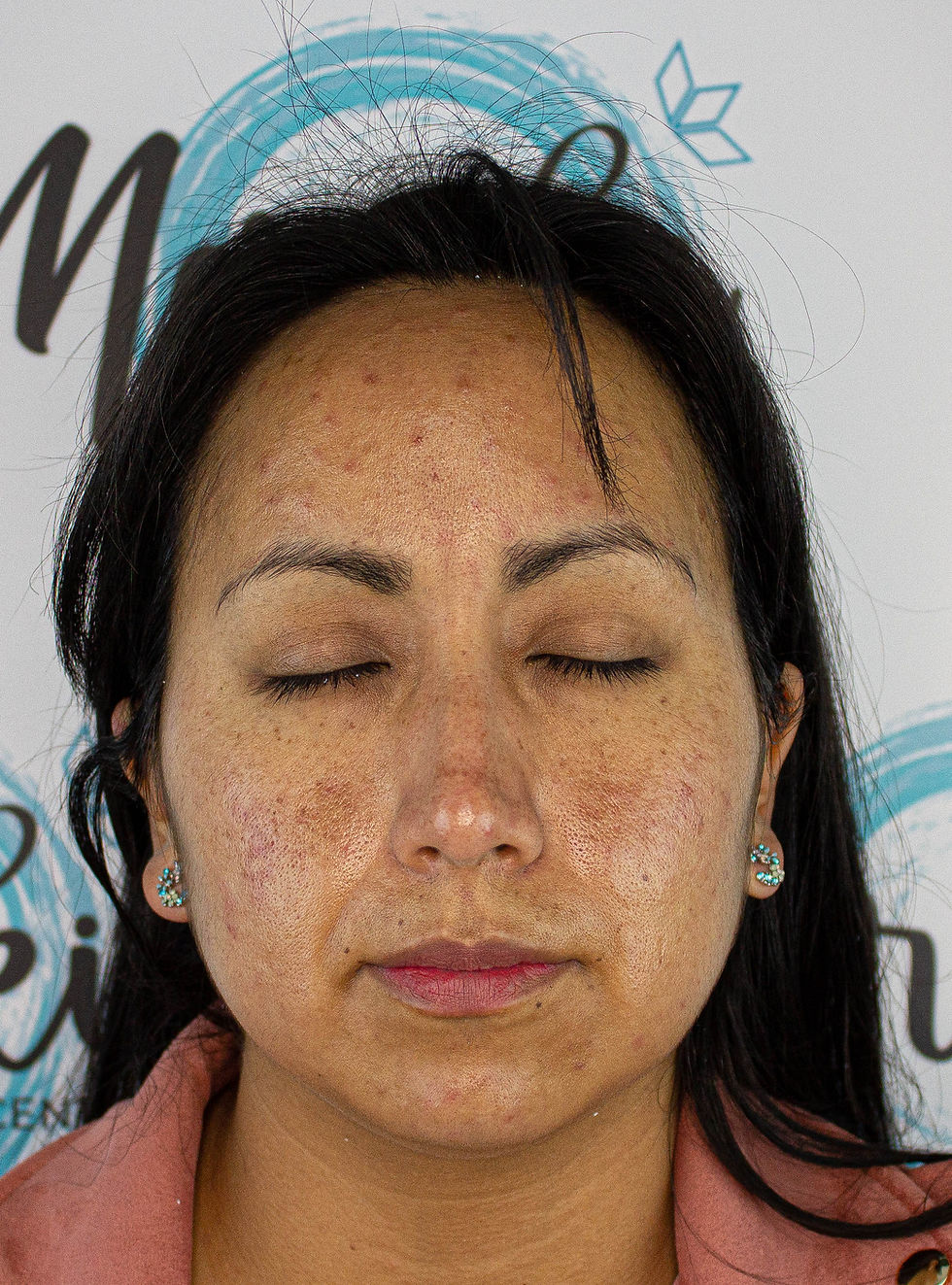 Spa, centro estetico,  meraki beauty center, tratamiento facial