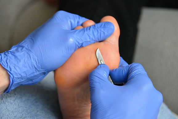 Pédicure médicale.JPG