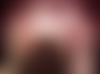 Лечение инсульта в Москве жителям Подмосковья бесплатно