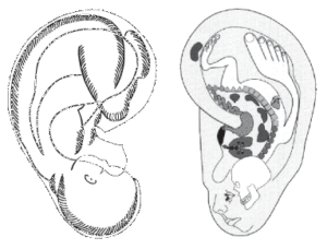 auricular-3-300x228.gif