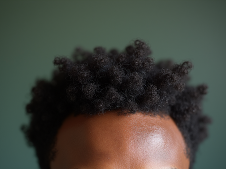Beezzz emphasizing the beauty of scalp health
