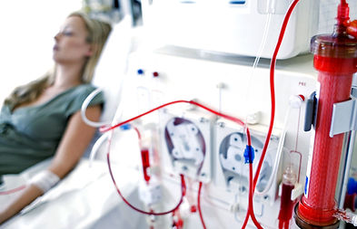 RENAL_DIALYSIS-56a275235f9b58b7d0cac1e2.