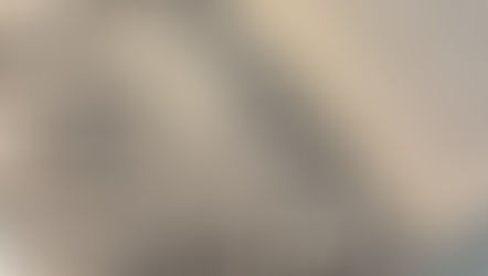 “Explante, explante meu”.