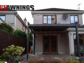 Why Every Irish Home Needs a Retractable Awning in 2026