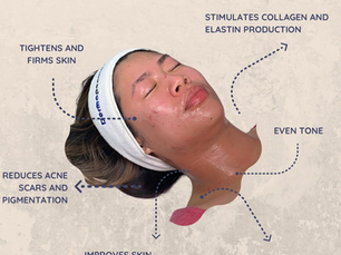 Microneedling Treatment: An Innovation That Transforms Your Skin