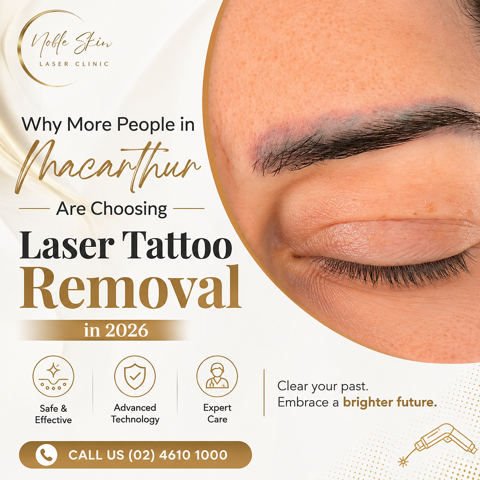 Why More People in Macarthur Are Choosing Laser Tattoo Removal in 2026
