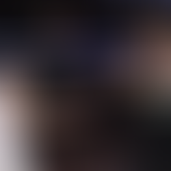 Bucks’ Grayson Allen underwent surgery on finger