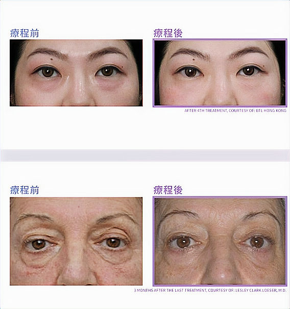 Screenshot 2025-11-08 165716_edited.jpg