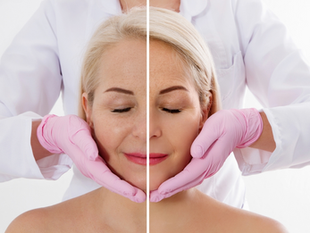 The Science behind Wrinkle Reduction Injections and Their Lasting Results