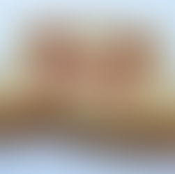 Sympathy For Food Workers Who Suffer